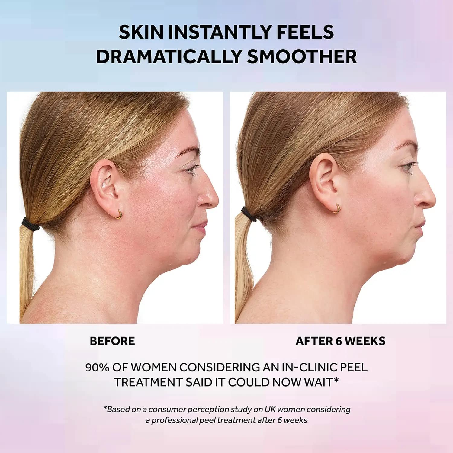 No7 Laboratories Resurfacing Peel 15% Glycolic Acid - Skin Resurfacing Face Peel for Smoother Skin - Brightening Pore Cleanser + Face Peeling Treatment for Impurities & Dead Skin Cells (30ml)